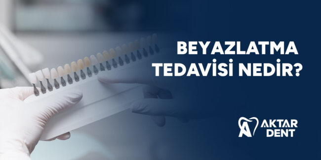 beyazlatma-tedavisi-nedir-gorsel