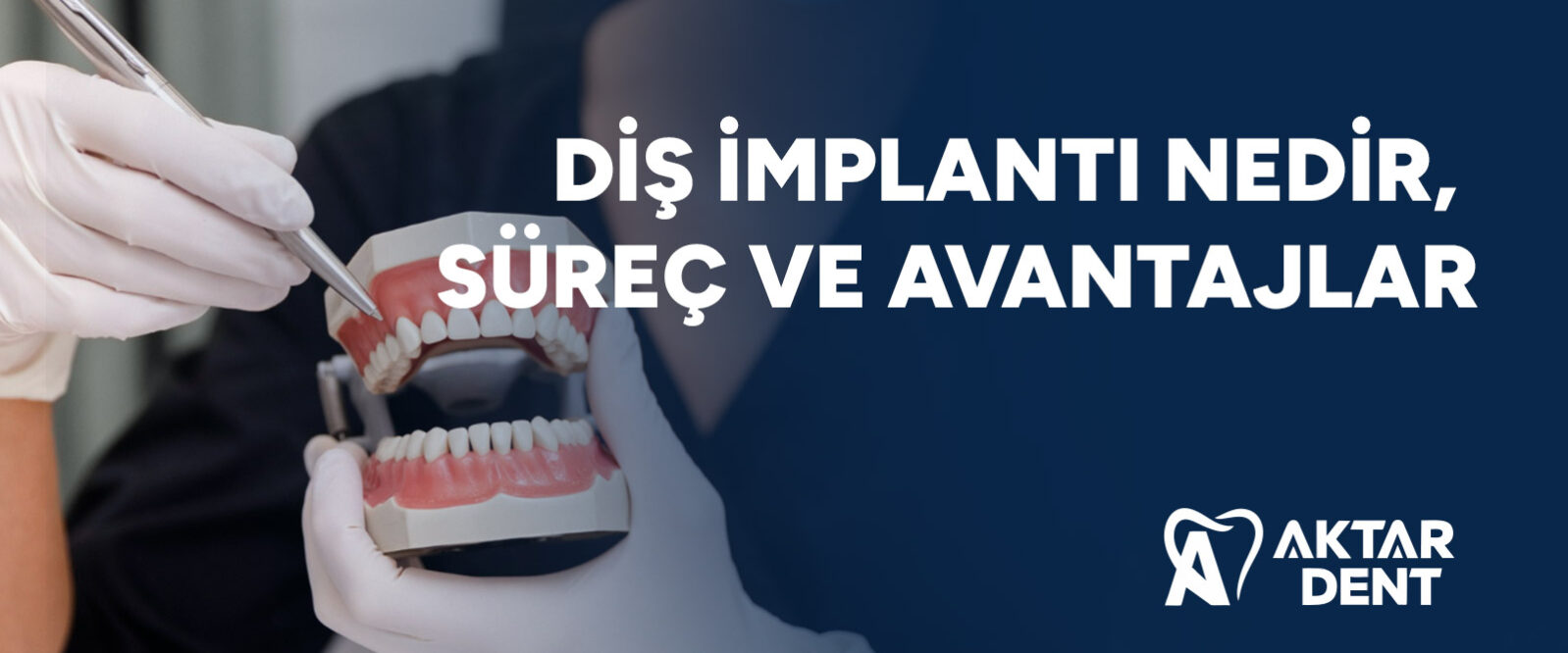 dis-implanti-nedir-surec-ve-avantajlar-gorsel