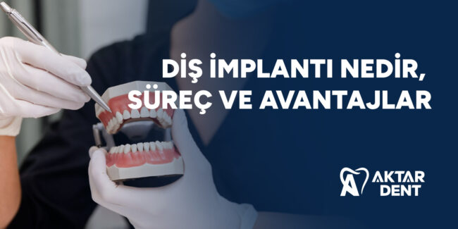 dis-implanti-nedir-surec-ve-avantajlar-gorsel