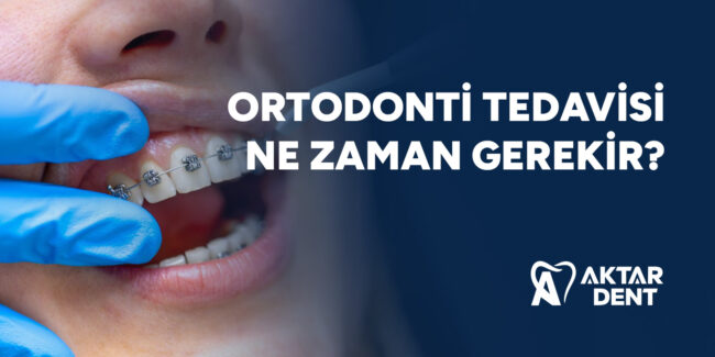 ortodonti-tedavisi-ne-zaman-gerekir-gorsel